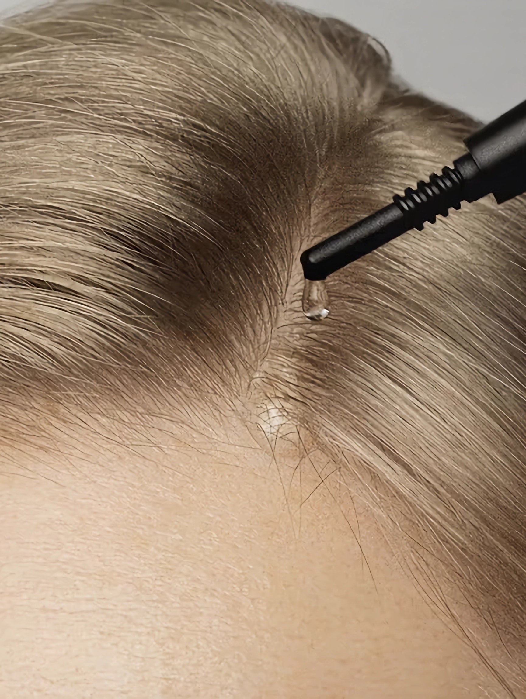 Scalp Peel Serum 4